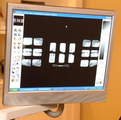 Modesto Digital X-Rays